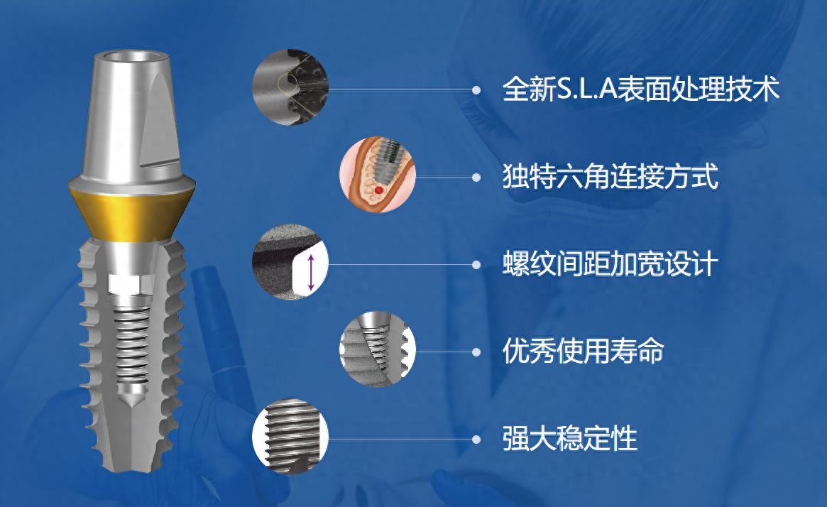 http://www.bstoo.cn/d/file/price/ywcjrr14ykml.jpg