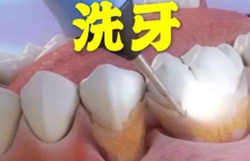 http://www.bstoo.cn/d/file/price/z0jj2b45zht2.jpg
