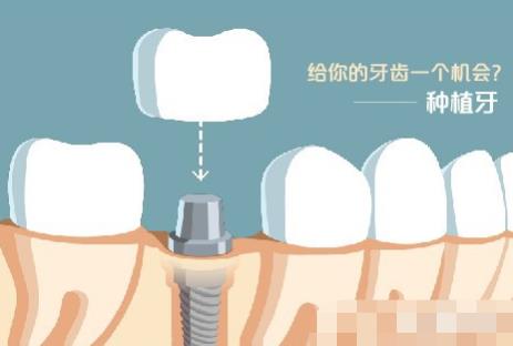 http://www.bstoo.cn/d/file/price/z9thee23hjgs.jpg