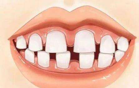 http://www.bstoo.cn/d/file/price/zbas3v2q8ptg.jpg