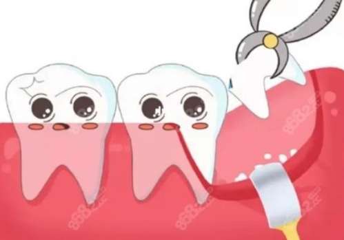 http://www.bstoo.cn/d/file/price/zv50pf8o15bb.jpg
