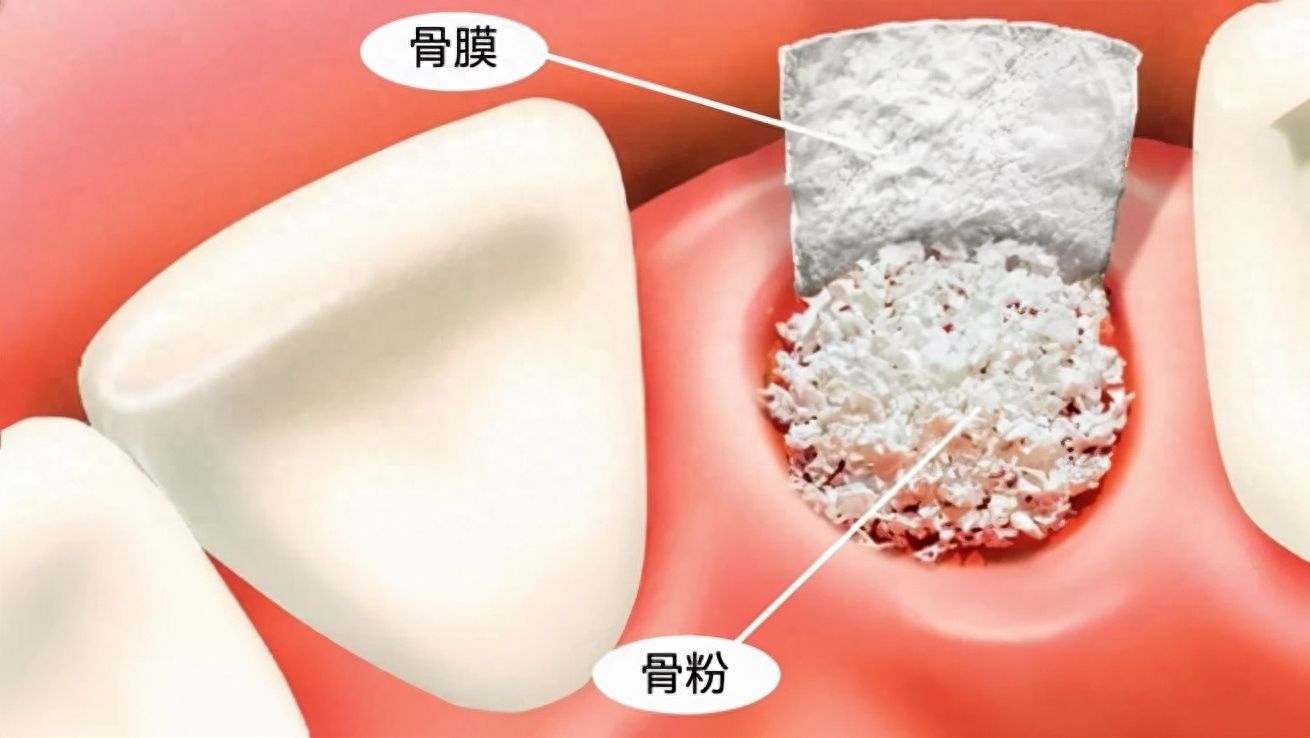 http://www.bstoo.cn/d/file/price/zw0blpjth1je.jpg