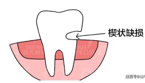 http://www.bstoo.cn/d/file/rank/1xedfrm28kyr.jpg