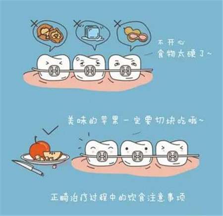 三水人民醫(yī)院種植牙價(jià)格及醫(yī)生解答