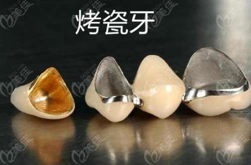 鄭州金水區(qū)口腔醫(yī)院推薦：解讀唯美口腔種植牙技術(shù)及專家團(tuán)隊(duì)