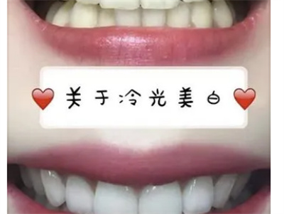 http://www.bstoo.cn/d/file/rank/3pi3k6gehs0z.jpg