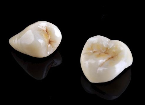 深圳牙齒矯正價(jià)目表一覽：專家點(diǎn)評(píng)，實(shí)力測(cè)評(píng)