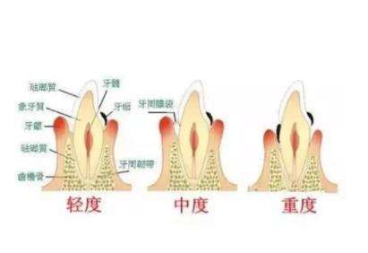 南京口腔診所排行榜前三，專家推薦！