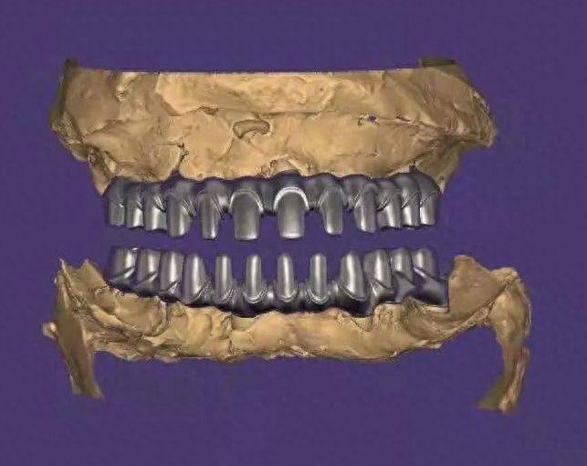 http://www.bstoo.cn/d/file/rank/a0ljo87jmvgy.jpg