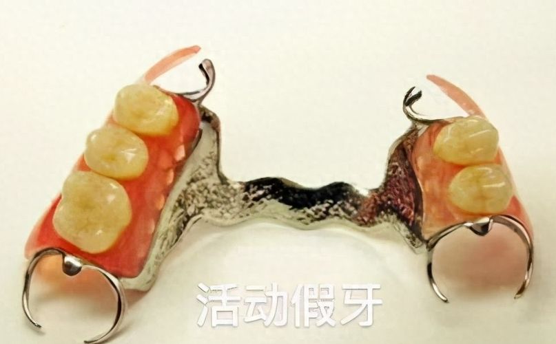 重慶牙科種植醫(yī)院排行榜：專家推薦，性價(jià)比高！