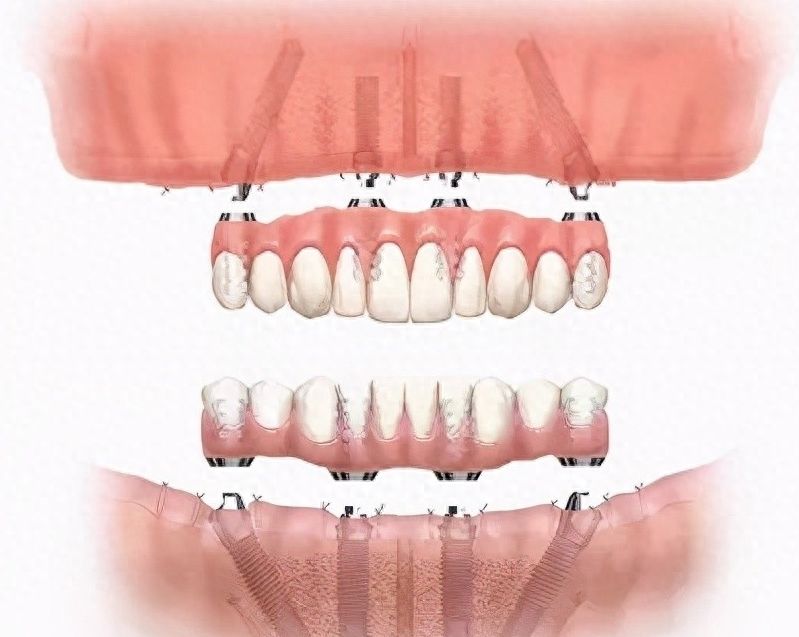 http://www.bstoo.cn/d/file/rank/bgjarq9i3bxr.jpg