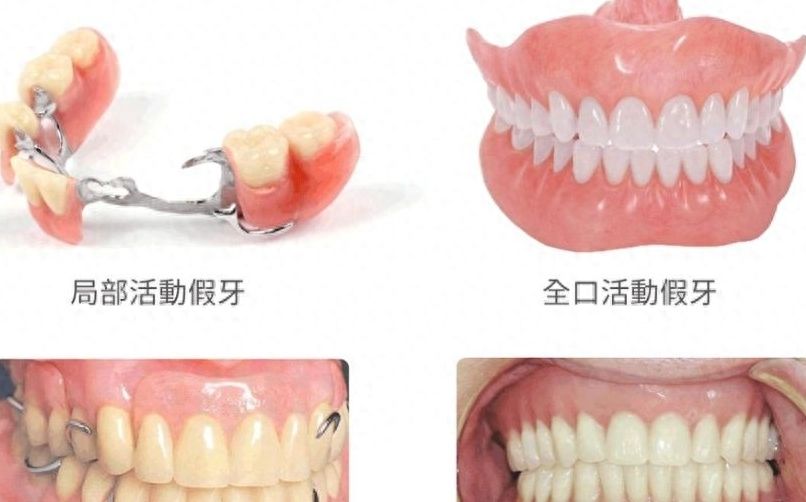 http://www.bstoo.cn/d/file/rank/bp5atlhm4uc9.jpg
