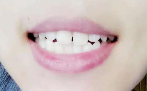 http://www.bstoo.cn/d/file/rank/calpx7hdseyg.jpg