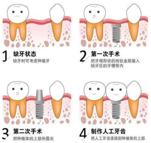 濰坊口腔醫(yī)院專家排行榜前五揭曉