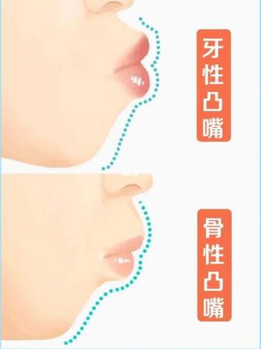 http://www.bstoo.cn/d/file/rank/fin0vlegmg0a.jpg