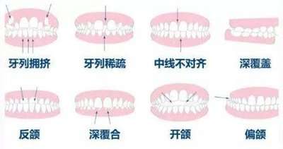 http://www.bstoo.cn/d/file/rank/gtkuohofh2wy.jpg