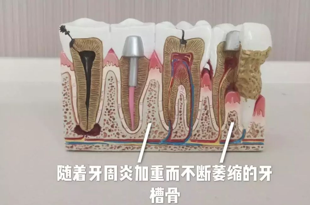 上海博厚口腔種植牙怎么樣？附地址及董燕群醫(yī)生介紹