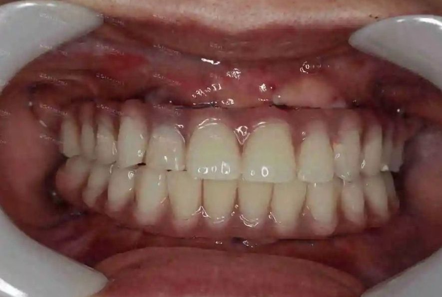 http://www.bstoo.cn/d/file/rank/h4h02lreckhs.jpg