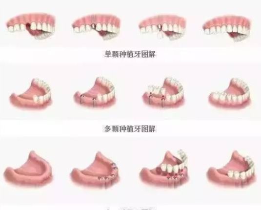 上海尤旦口腔口碑好不好？醫(yī)院地址、醫(yī)生和收費(fèi)參考