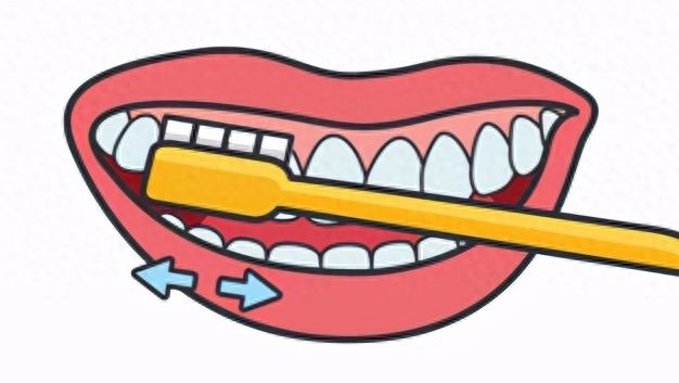 北京同仁醫(yī)院牙齒拋光攻略：費(fèi)用及專家推薦