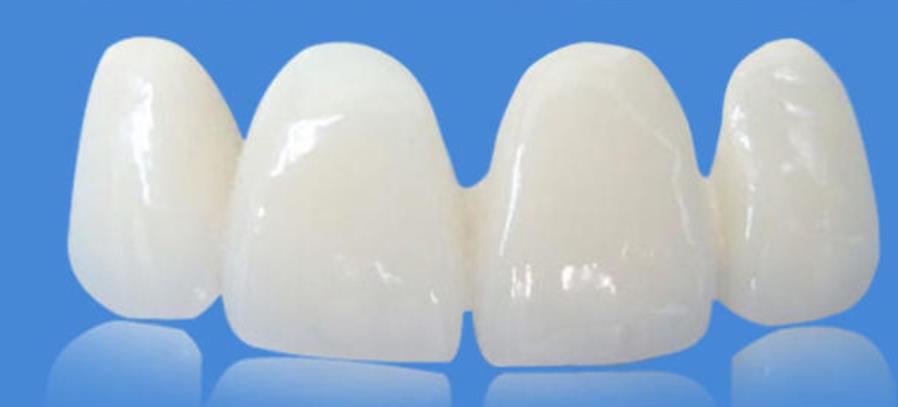 http://www.bstoo.cn/d/file/rank/ld78r75nxp.jpg