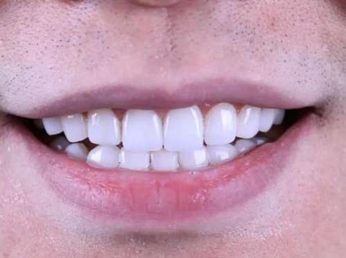 嘉興正畸推薦牙科：口碑好的正畸醫(yī)生指南