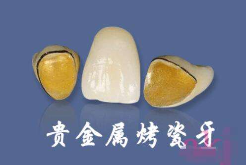 http://www.bstoo.cn/d/file/rank/mixsm96w1lmu.jpg