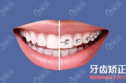 http://www.bstoo.cn/d/file/rank/nb87jb4if5.jpg