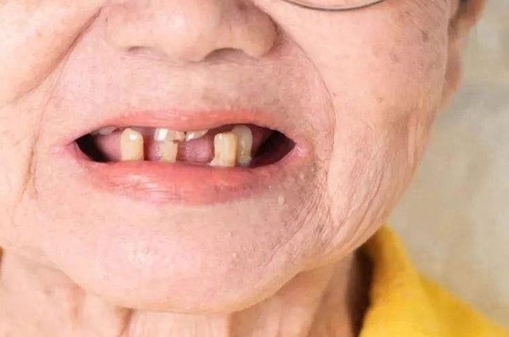 上海第七人民醫(yī)院矯正牙齒價格查詢及口腔醫(yī)生建議