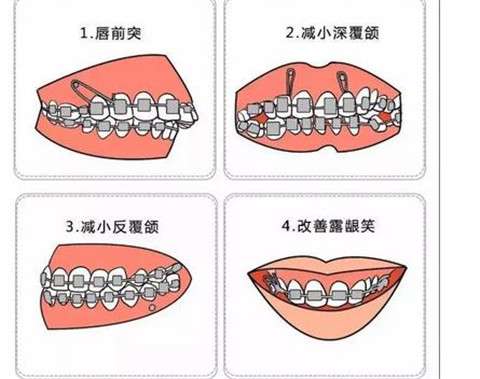 http://www.bstoo.cn/d/file/rank/rog08pc317em.jpg