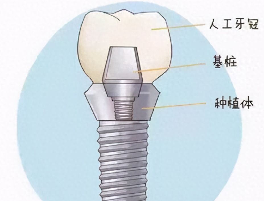 http://www.bstoo.cn/d/file/rank/vsf40w703j1t.jpg