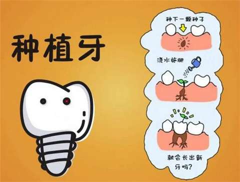 上海第十人民醫(yī)院種植牙詳解：醫(yī)生技能、真實(shí)案例分享