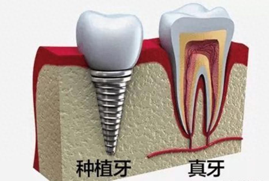 http://www.bstoo.cn/d/file/rank/w9jz0izhz961.jpg