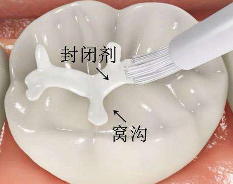 南寧市諾貝爾口腔：種植專家武海波聯(lián)系方式