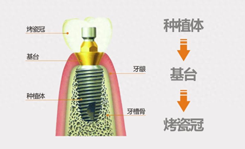 http://www.bstoo.cn/d/file/rank/wpsql562zwa5.jpg