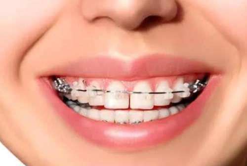 http://www.bstoo.cn/d/file/rank/xn300qd5iyd8.jpg