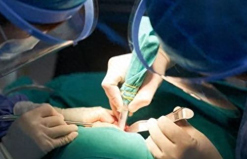 南京美奧口腔牙齒矯正攻略：朱峰、陳玉潔醫(yī)生技術(shù)解析